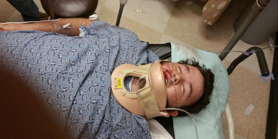 “It’s A Hate Crime”: White Teen Beaten Into Critical Condition By Blacks For Posting “Blue Lives Matter”